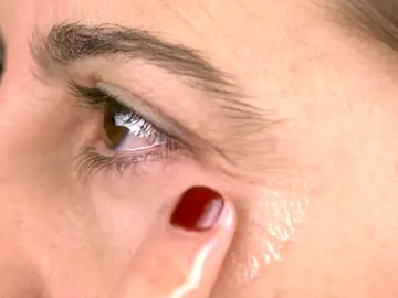 Tratamiento casero contra las patas de gallo Tratamiento casero contra las patas de gallo