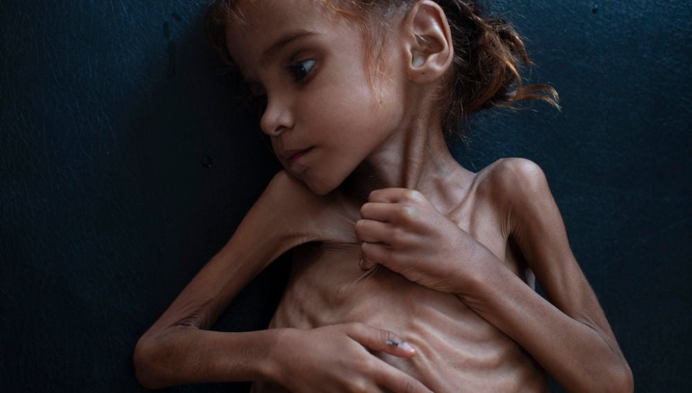 La pequeña Amal Hussain