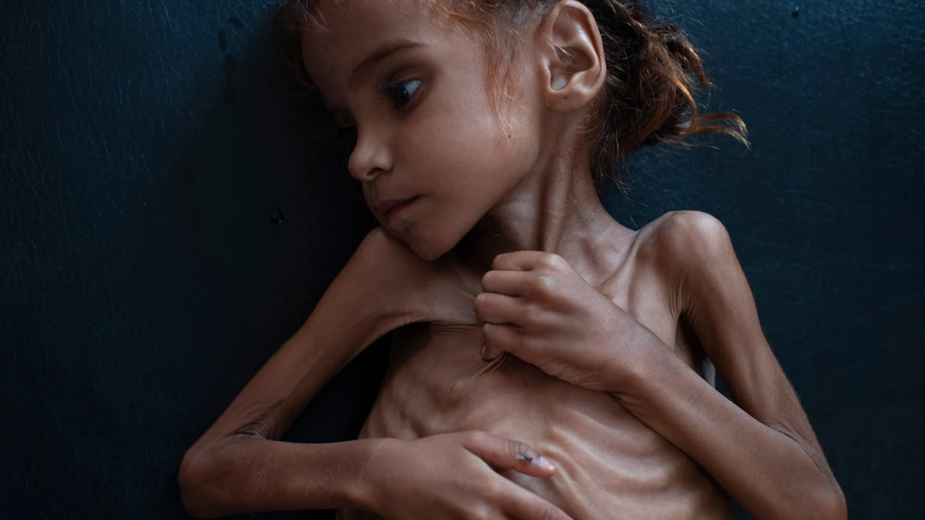 La pequeña Amal Hussain La pequeña Amal Hussain