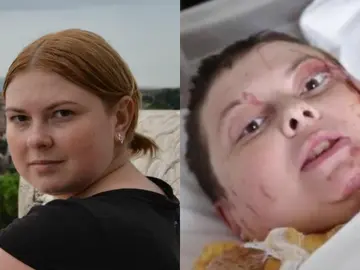 Kateryna Handziuk, la activista ucraniana Kateryna Handziuk, la activista ucraniana