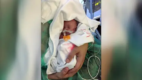 El bebé guerrero vuelve al hospital donde nació El bebé guerrero vuelve al hospital donde nació