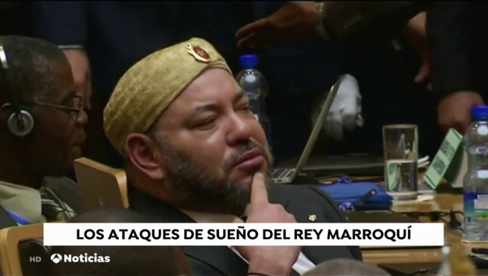 REEMPLAZO Desvelada la enfermedad del rey de Marruecos. Mohamed VI padece sarcoidosis