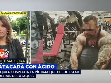 Una joven atacada con ácido por un encapuchado: "¡Me quema, me quema! Ha sido mi expareja" Una joven atacada con ácido por un encapuchado: "¡Me quema, me quema! Ha sido mi expareja"