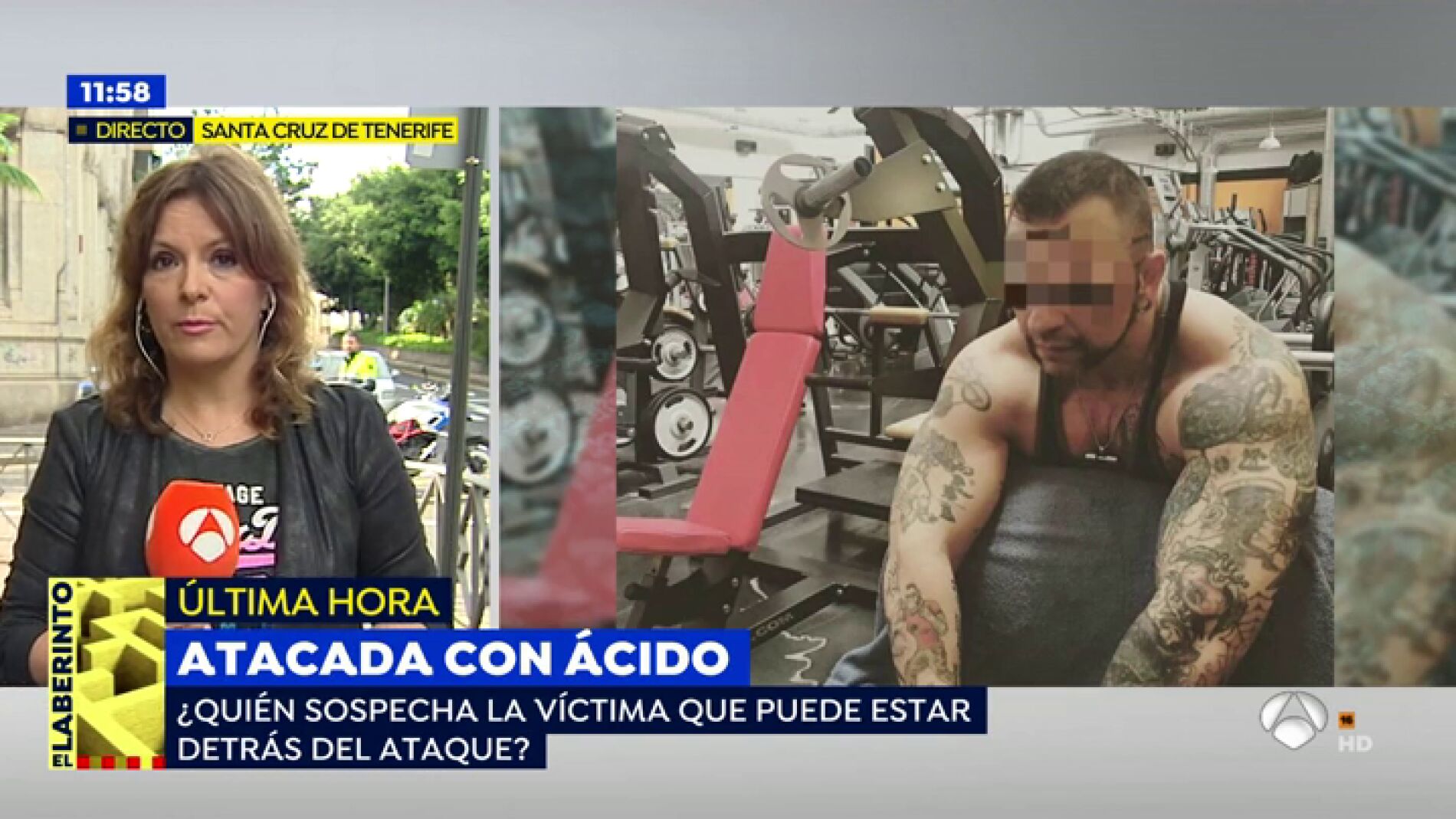 Una joven atacada con &aacute;cido por un encapuchado: "&iexcl;Me quema, me quema! Ha sido mi expareja"