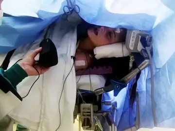 Una chica canta mientras la operan de un tumor cerebral Una chica canta mientras la operan de un tumor cerebral