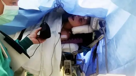 Una chica canta mientras la operan de un tumor cerebral Una chica canta mientras la operan de un tumor cerebral