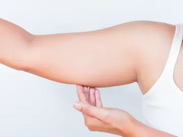 Grasa en los brazos Grasa en los brazos