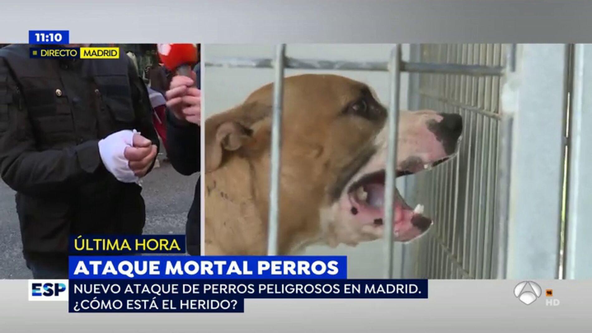 Un nuevo ataque de un perro peligroso rompe la mano a la v&iacute;ctima: "He cogido miedo a los perros, aunque la culpa es del due&ntilde;o"
