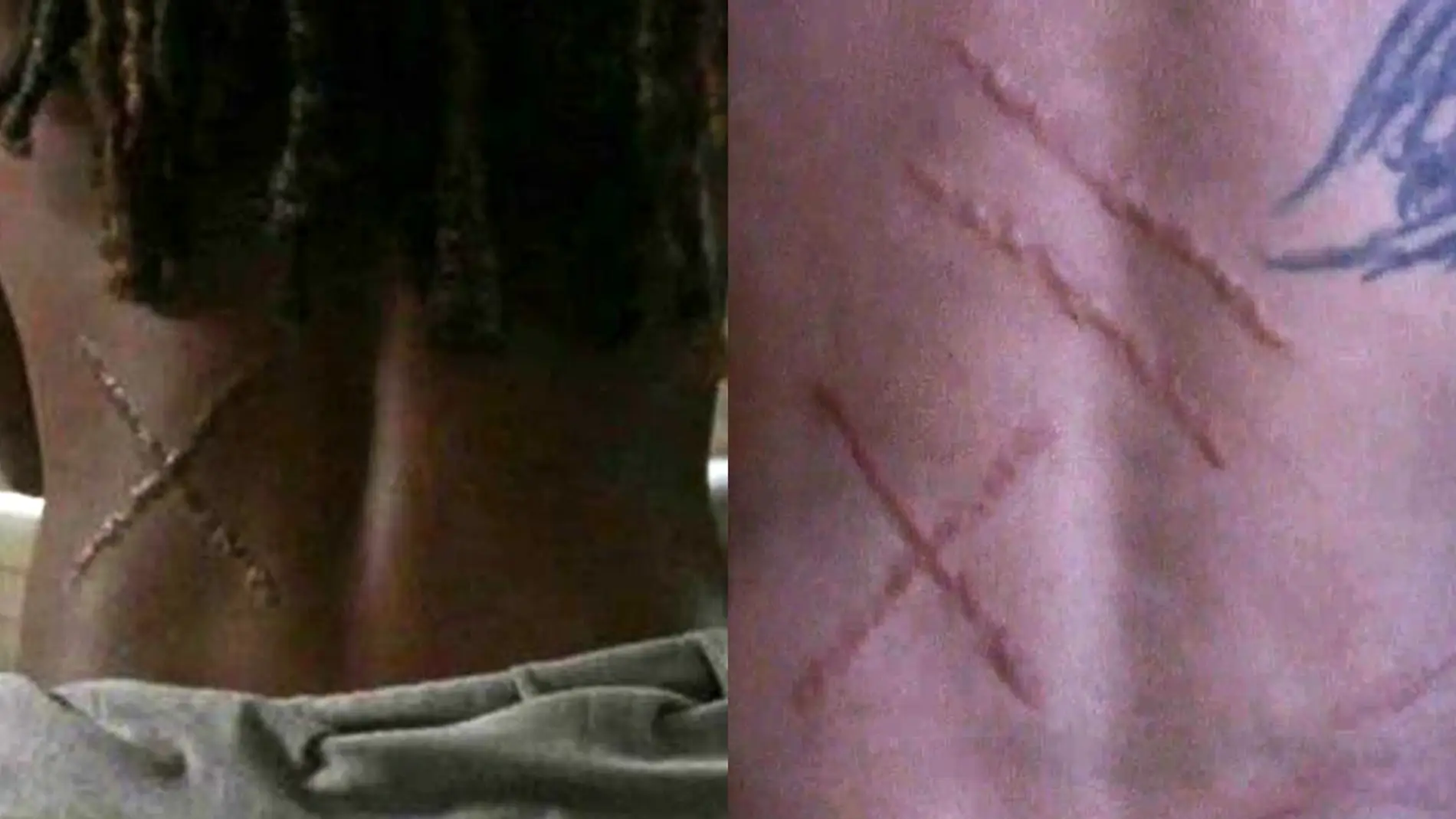Cicatrices de Michonne y Daryl en 'The Walking Dead'