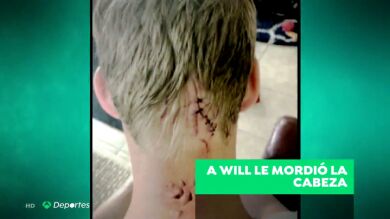 Cebo deportes 29/11/18: 'A Will le mordió la cabeza'