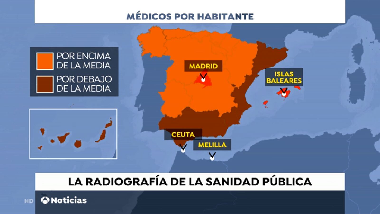 ¿Cuáles son las comunidades autónomas con más y menos lista de espera quirúrgica?