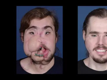 Reconstrucción facial de Cameron Underwood Reconstrucción facial de Cameron Underwood