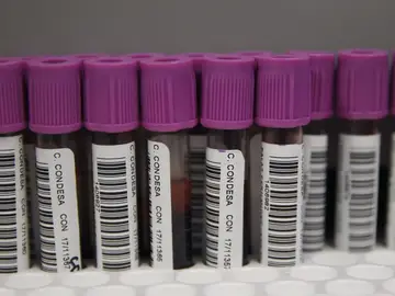 Muestras para la prueba de VIH Muestras para la prueba de VIH