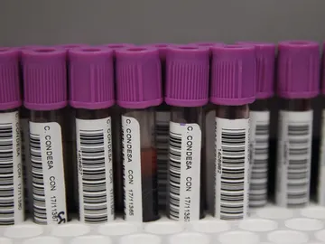 Muestras para la prueba de VIH Muestras para la prueba de VIH