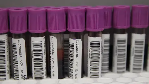 Muestras para la prueba de VIH Muestras para la prueba de VIH