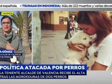 Ataque de perros peligrosos a la teniente de alcalde de Valencia Ataque de perros peligrosos a la teniente de alcalde de Valencia