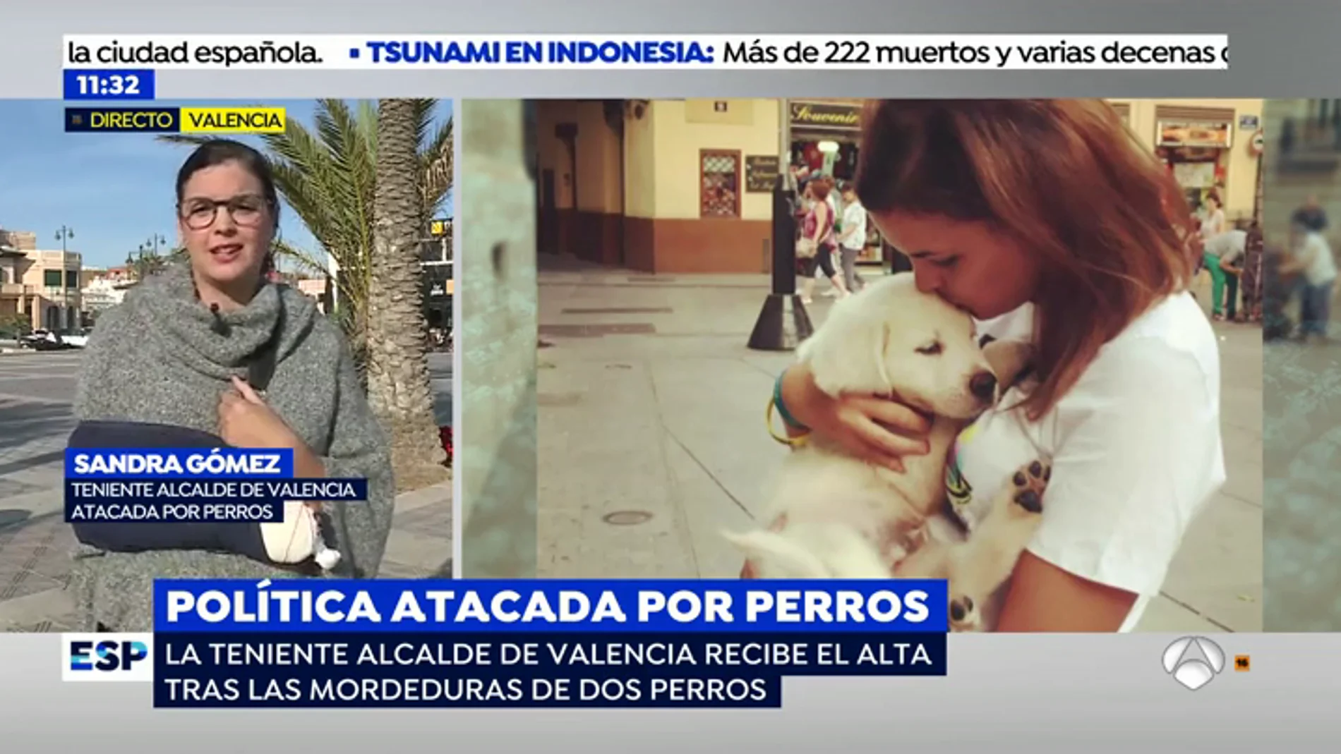 Ataque de perros peligrosos a la teniente de alcalde de Valencia