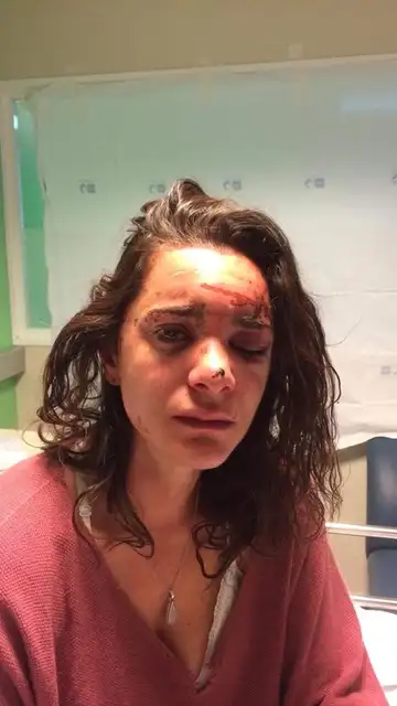 Andrea sufrió graves heridas en un ojo Andrea sufrió graves heridas en un ojo