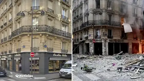 antesydespues antesydespues