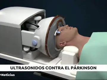 Ultrasonidos contra el parkinson Ultrasonidos contra el parkinson