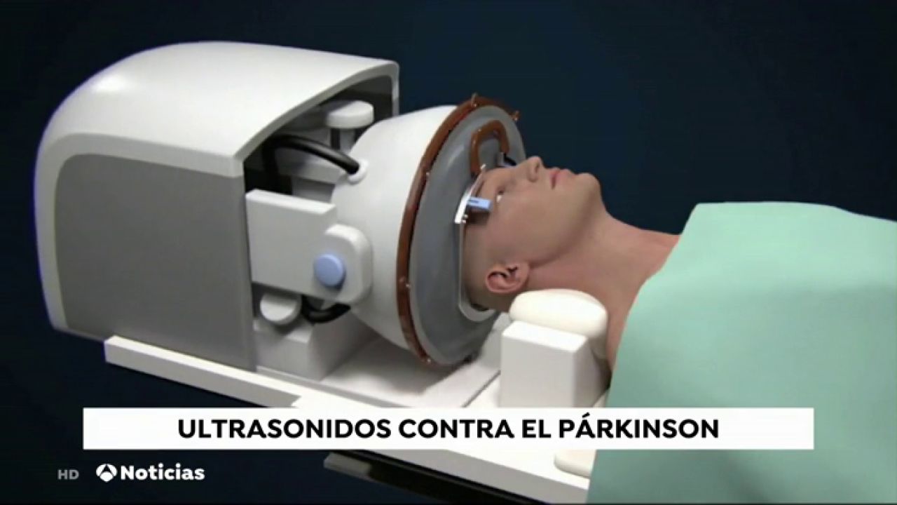 Ultrasonidos contra el parkinson: la última técnica de la Clínica  Universidad de Navarra para tratar la enfermedad