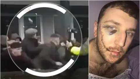 El momento del apuñalamiento a un seguidor del Everton El momento del apuñalamiento a un seguidor del Everton