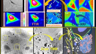 La luz de sincrotron revela nuevos detalles sobre la esclerosis lateral amiotrofica