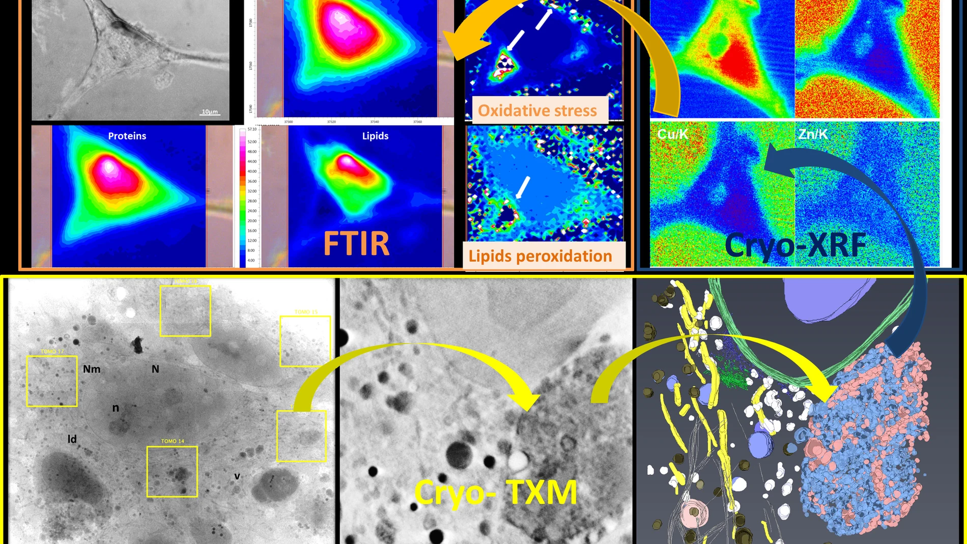 La luz de sincrotron revela nuevos detalles sobre la esclerosis lateral amiotrofica La luz de sincrotron revela nuevos detalles sobre la esclerosis lateral amiotrofica