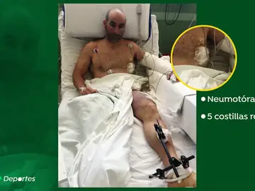 La pelea del montañero Susi para salvar su pie izquierdo La pelea del montañero Susi para salvar su pie izquierdo