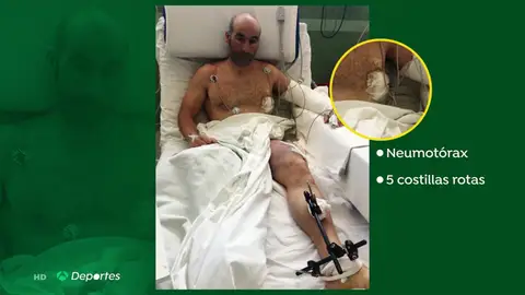 La pelea del montañero Susi para salvar su pie izquierdo La pelea del montañero Susi para salvar su pie izquierdo