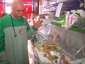 Mueren por falta de asistencia los bebés siameses de Yemen, icono de la crisis humanitaria del país Mueren por falta de asistencia los bebés siameses de Yemen, icono de la crisis humanitaria del país
