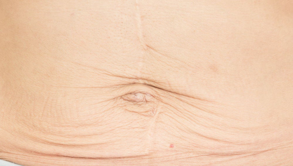Dieta para perder barriga despues del embarazo Dieta para perder barriga despues del embarazo