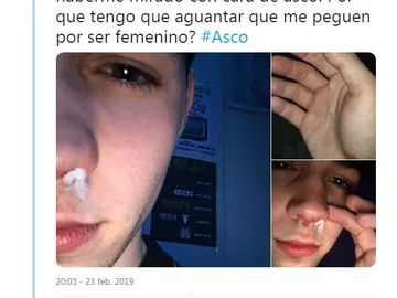 Agresión homófoba en una discoteca Agresión homófoba en una discoteca