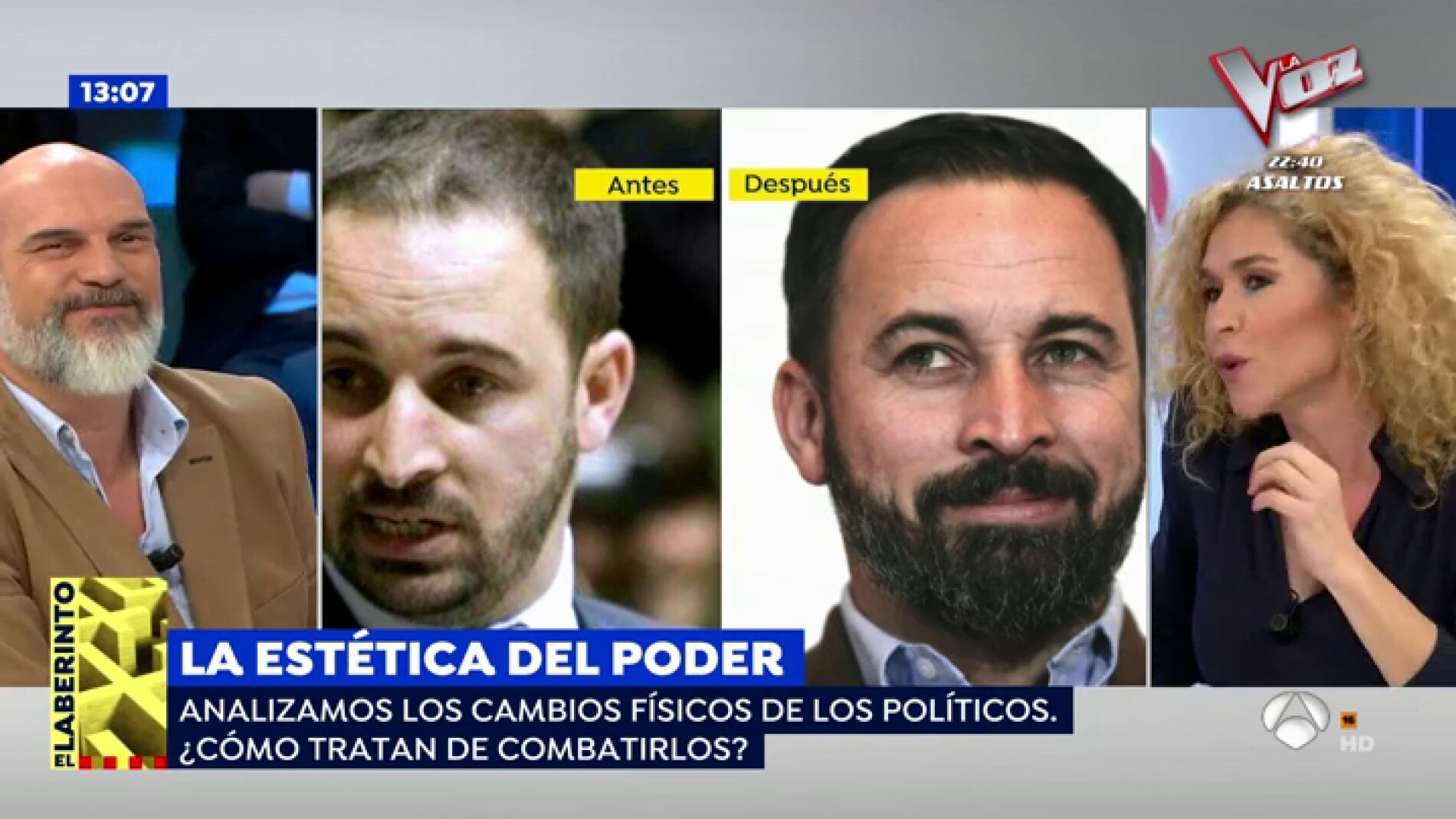 El antes y despu&eacute;s de Santiag Abascal