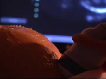 Una mujer se queda estéril tras someterse a 17 abortos en seis años Una mujer se queda estéril tras someterse a 17 abortos en seis años