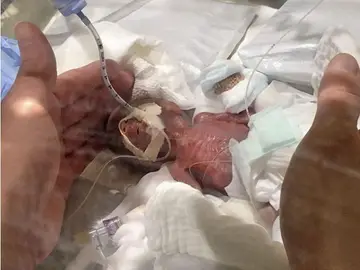 Imagen del bebé tras nacer Imagen del bebé tras nacer