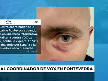 REEMPLAZO Vox REEMPLAZO Vox