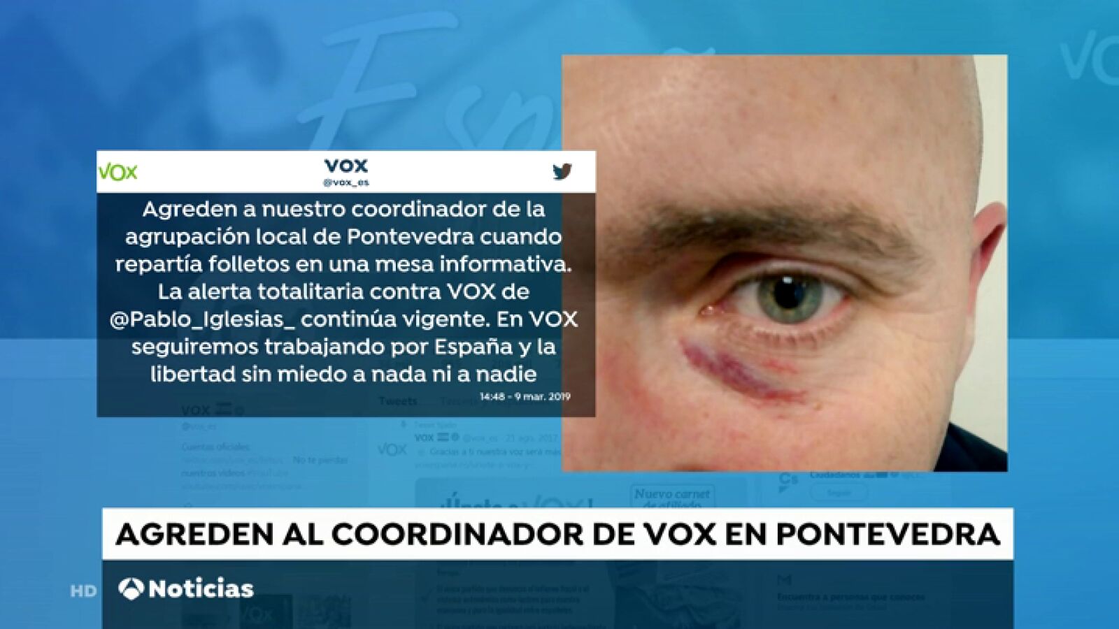 El joven que agredió a Rajoy en 2015 golpea ahora a un dirigente de Vox de Pontevedra
