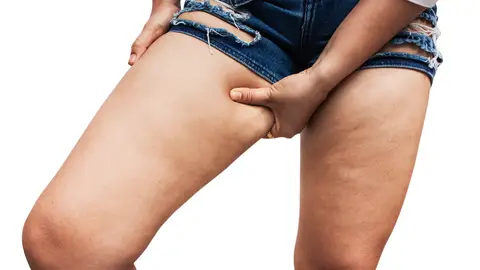 Grasa acumulada en los muslos Nova Life