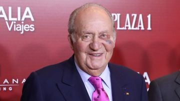 El Rey emérito Juan Carlos con el ojo morado