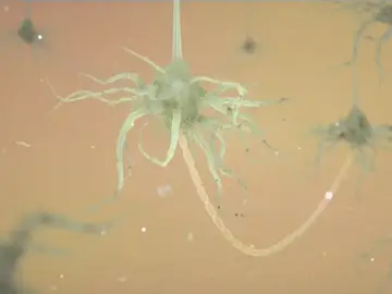 El cerebro humano genera nuevas neuronas hasta los 90 años El cerebro humano genera nuevas neuronas hasta los 90 años