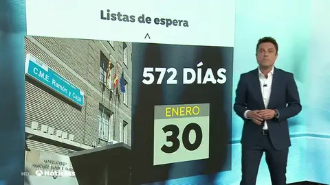 LISTAS ESPERA LISTAS ESPERA