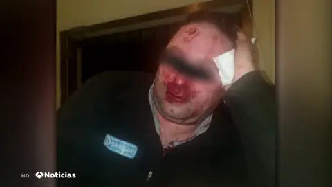 Un grupo de 'menas' agrede y provoca graves lesiones a un vigilante del centro de Hortaleza Un grupo de 'menas' agrede y provoca graves lesiones a un vigilante del centro de Hortaleza