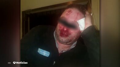 Un grupo de 'menas' agrede y provoca graves lesiones a un vigilante del centro de Hortaleza