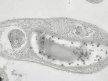 Descubren en Siberia la buscada bacteria capaz de vivir en Marte Descubren en Siberia la buscada bacteria capaz de vivir en Marte