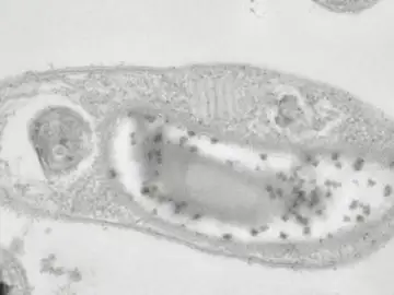 Descubren en Siberia la buscada bacteria capaz de vivir en Marte Descubren en Siberia la buscada bacteria capaz de vivir en Marte