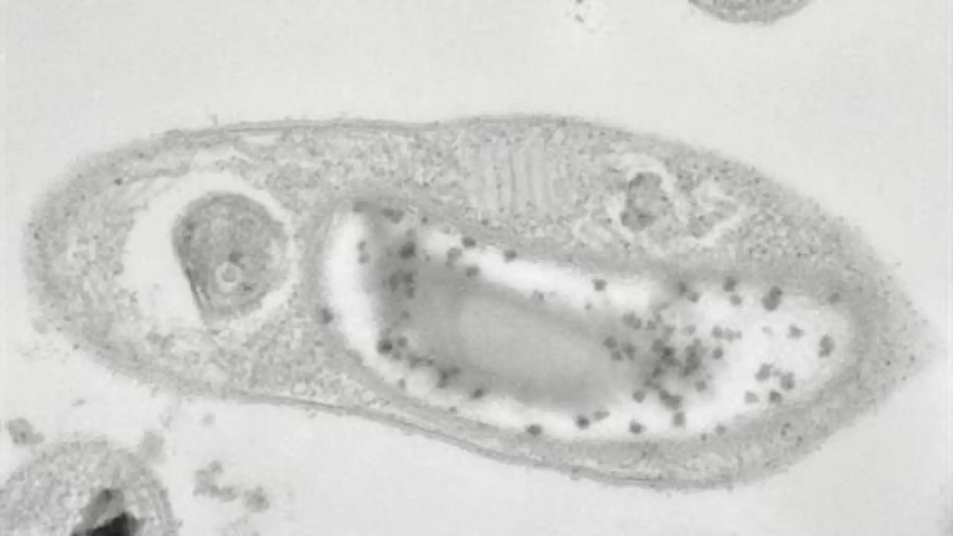 Descubren en Siberia la buscada bacteria capaz de vivir en Marte Descubren en Siberia la buscada bacteria capaz de vivir en Marte