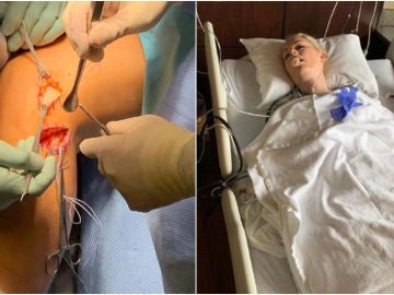 Imágenes de la operación de Lindsey Vonn