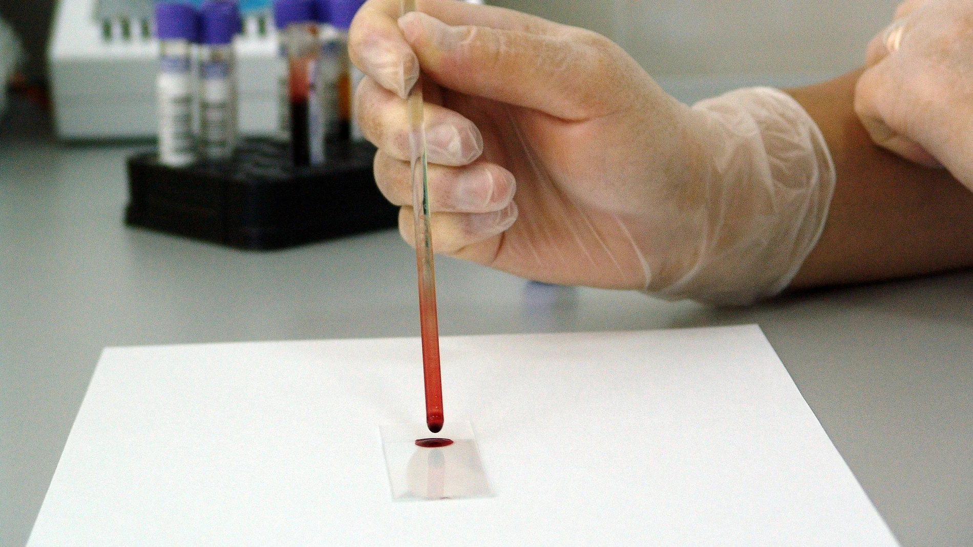 Análisis de una muestra de sangre en un laboratorio Análisis de una muestra de sangre en un laboratorio