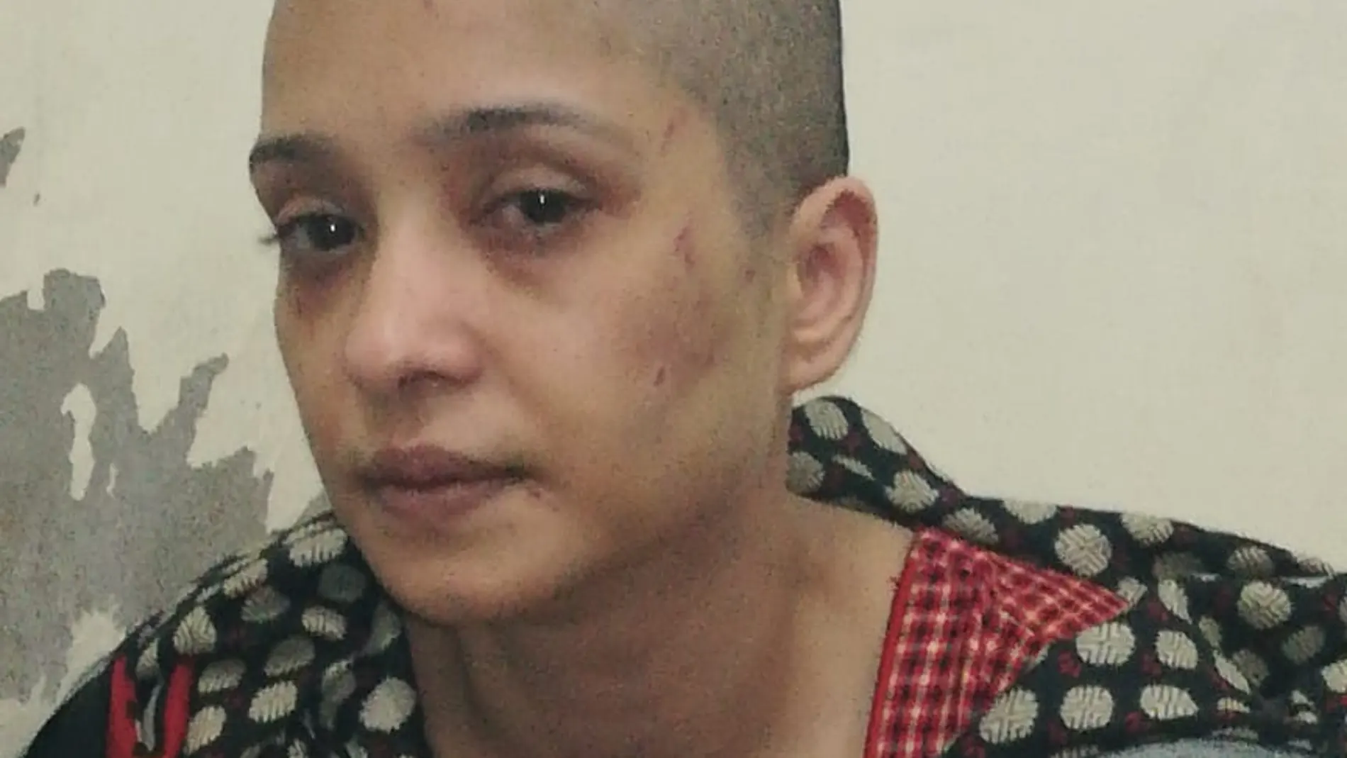 La mujer tras ser golpeada La mujer tras ser golpeada